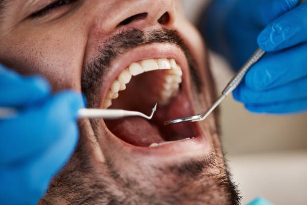 Best Broken or Chipped Tooth Repair in Hebron, KY